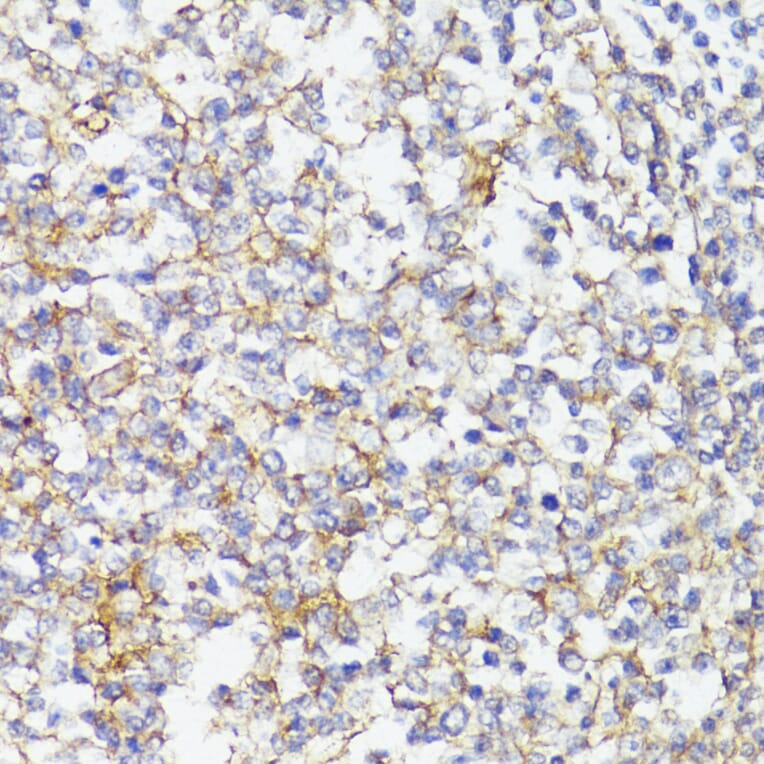 Immunohistochemistry - Anti-CD276 Antibody (A88024) - Antibodies.com