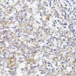 Immunohistochemistry - Anti-CD276 Antibody (A88024) - Antibodies.com