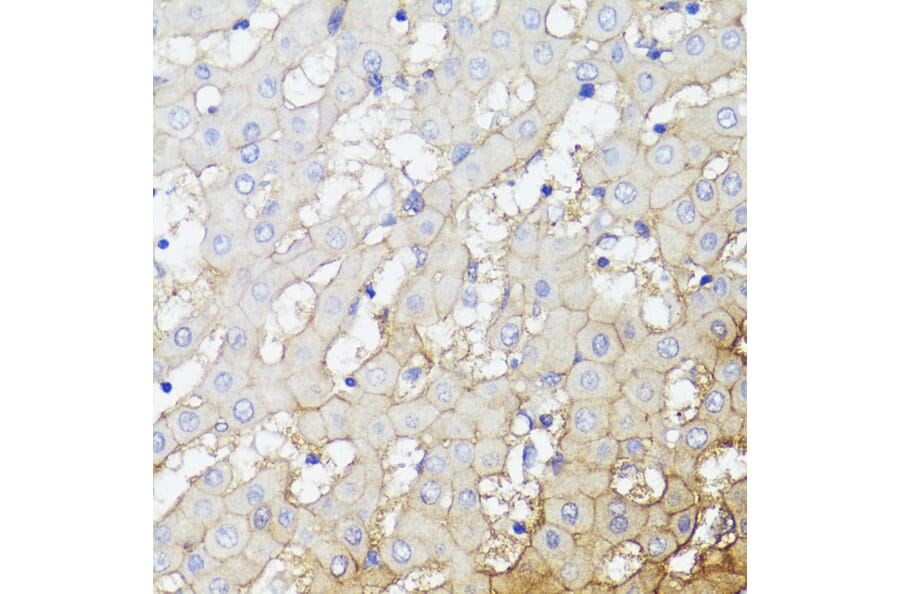Immunohistochemistry - Anti-CD276 Antibody (A88024) - Antibodies.com