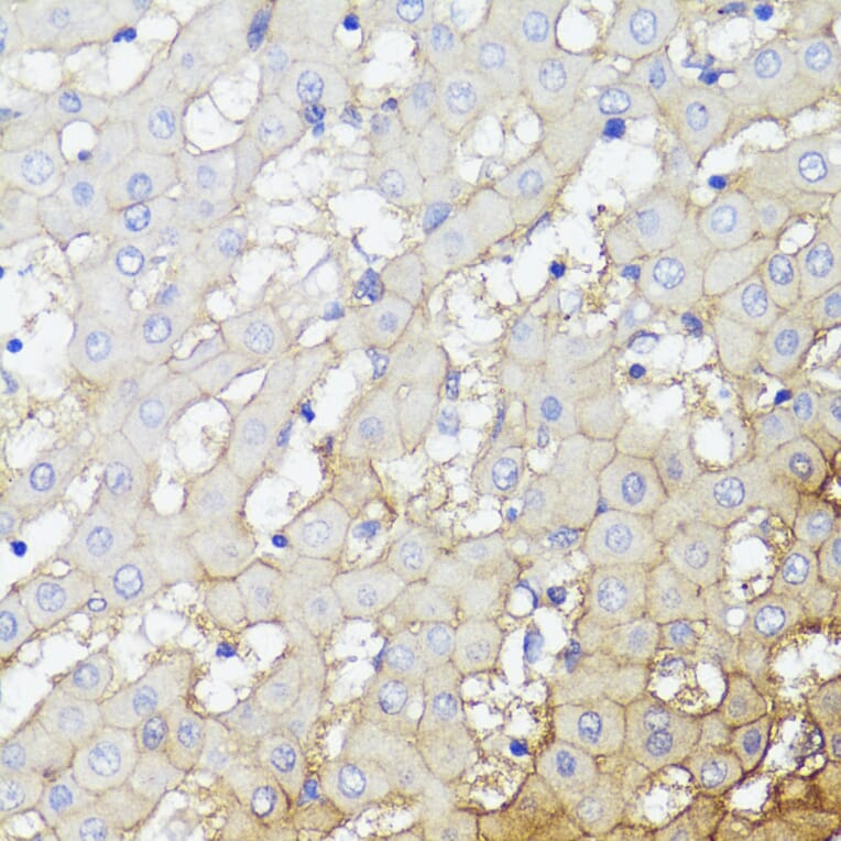 Immunohistochemistry - Anti-CD276 Antibody (A88024) - Antibodies.com