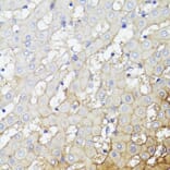 Immunohistochemistry - Anti-CD276 Antibody (A88024) - Antibodies.com