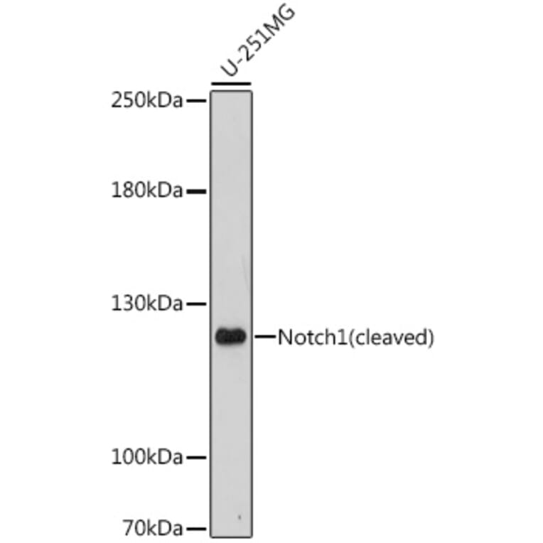 Western Blot - Anti-Notch1 Antibody (A88025) - Antibodies.com