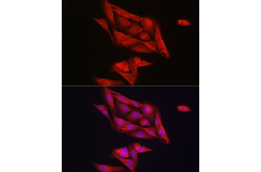 Immunofluorescence - Anti-Notch1 Antibody (A88025) - Antibodies.com