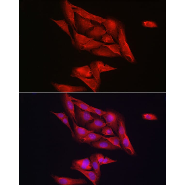 Immunofluorescence - Anti-Notch1 Antibody (A88025) - Antibodies.com