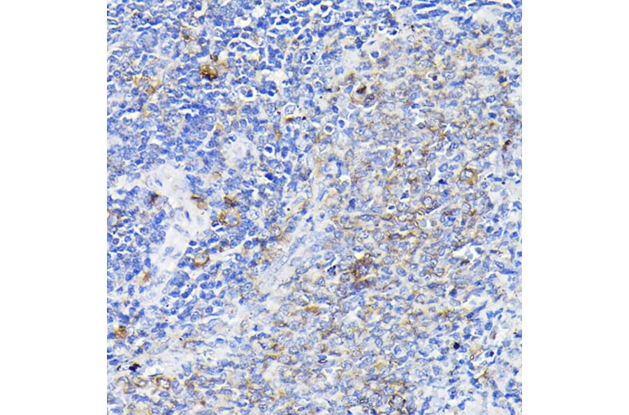 Immunohistochemistry - Anti-Notch1 Antibody (A88025) - Antibodies.com