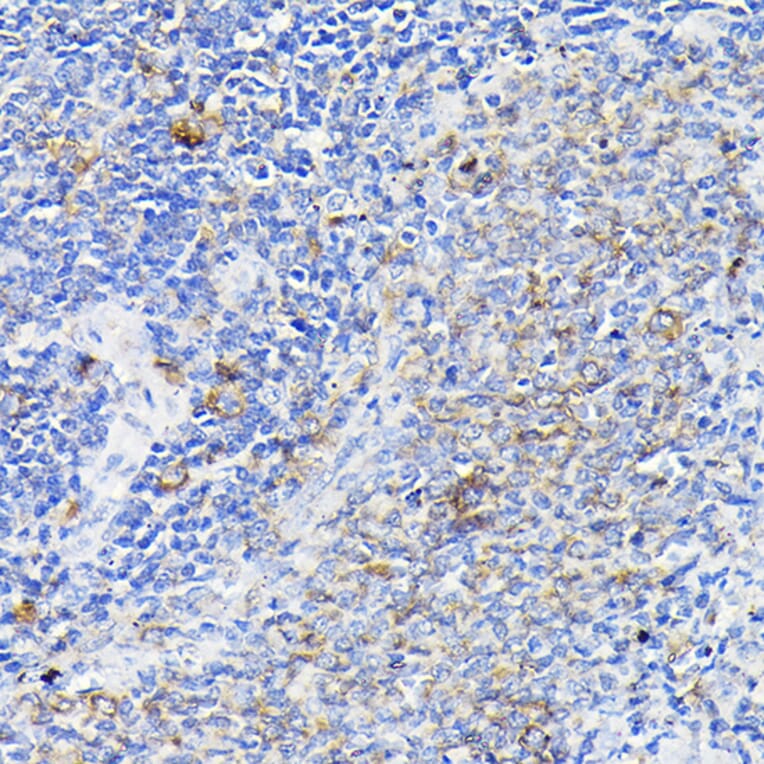 Immunohistochemistry - Anti-Notch1 Antibody (A88025) - Antibodies.com