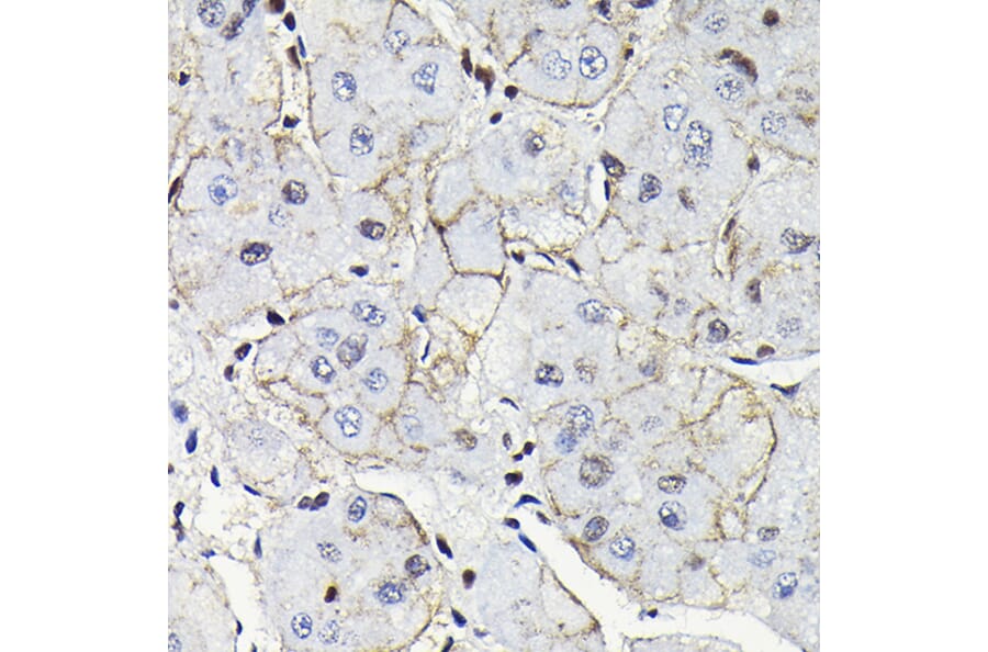 Immunohistochemistry - Anti-Notch1 Antibody (A88025) - Antibodies.com