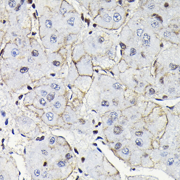 Immunohistochemistry - Anti-Notch1 Antibody (A88025) - Antibodies.com