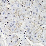 Immunohistochemistry - Anti-Notch1 Antibody (A88025) - Antibodies.com