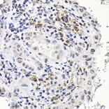 Immunohistochemistry - Anti-Notch1 Antibody (A88025) - Antibodies.com
