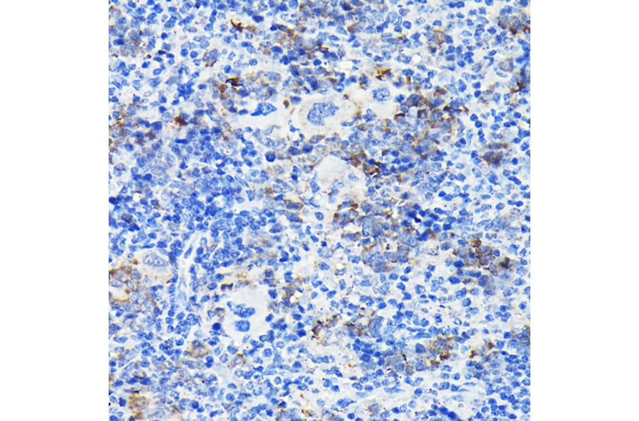 Immunohistochemistry - Anti-Notch1 Antibody (A88025) - Antibodies.com