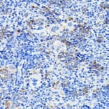 Immunohistochemistry - Anti-Notch1 Antibody (A88025) - Antibodies.com