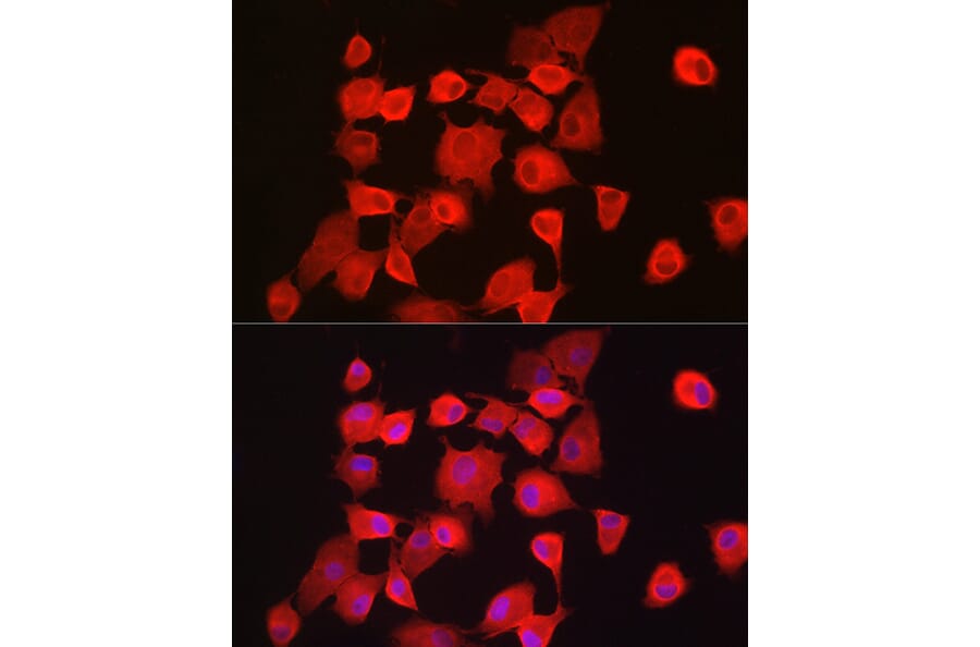 Immunofluorescence - Anti-Notch1 Antibody (A88025) - Antibodies.com