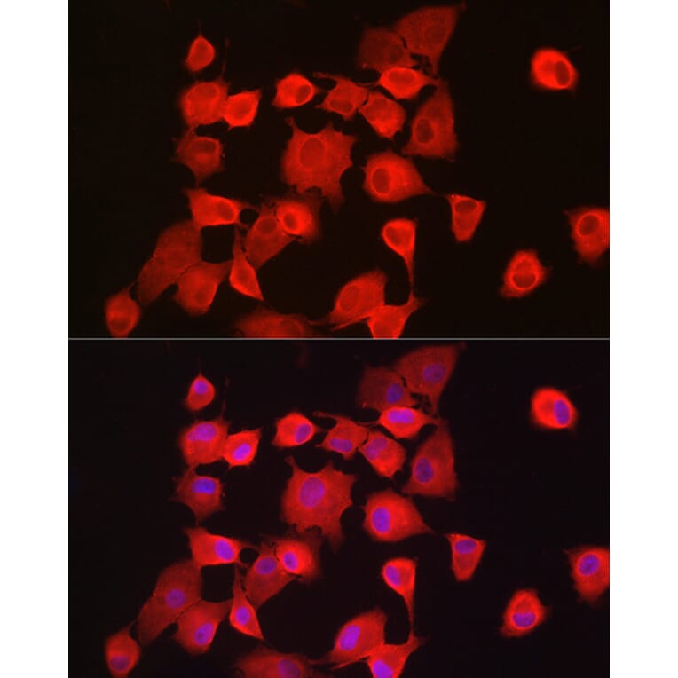 Immunofluorescence - Anti-Notch1 Antibody (A88025) - Antibodies.com