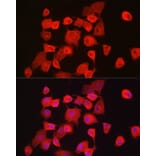 Immunofluorescence - Anti-Notch1 Antibody (A88025) - Antibodies.com