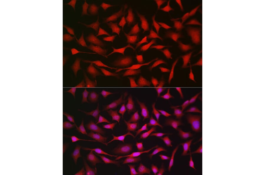 Immunofluorescence - Anti-Notch1 Antibody (A88025) - Antibodies.com