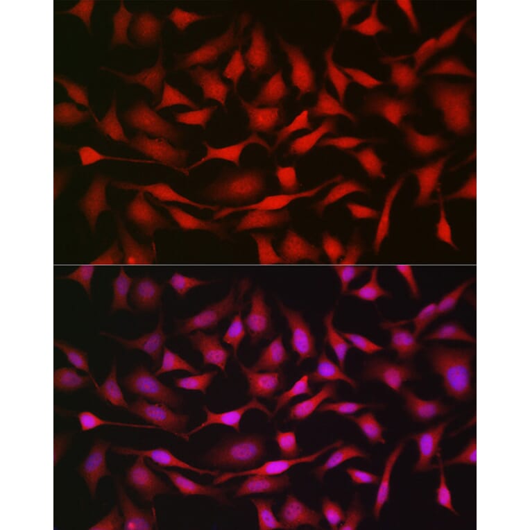 Immunofluorescence - Anti-Notch1 Antibody (A88025) - Antibodies.com