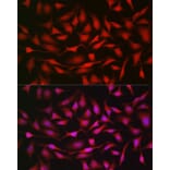 Immunofluorescence - Anti-Notch1 Antibody (A88025) - Antibodies.com