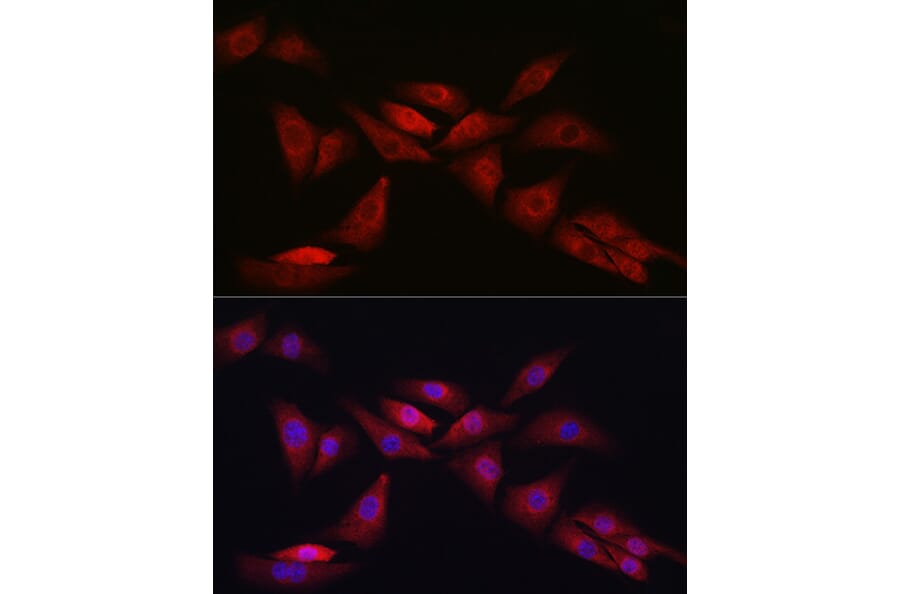 Immunofluorescence - Anti-Notch1 Antibody (A88025) - Antibodies.com