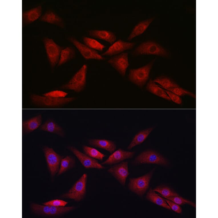 Immunofluorescence - Anti-Notch1 Antibody (A88025) - Antibodies.com