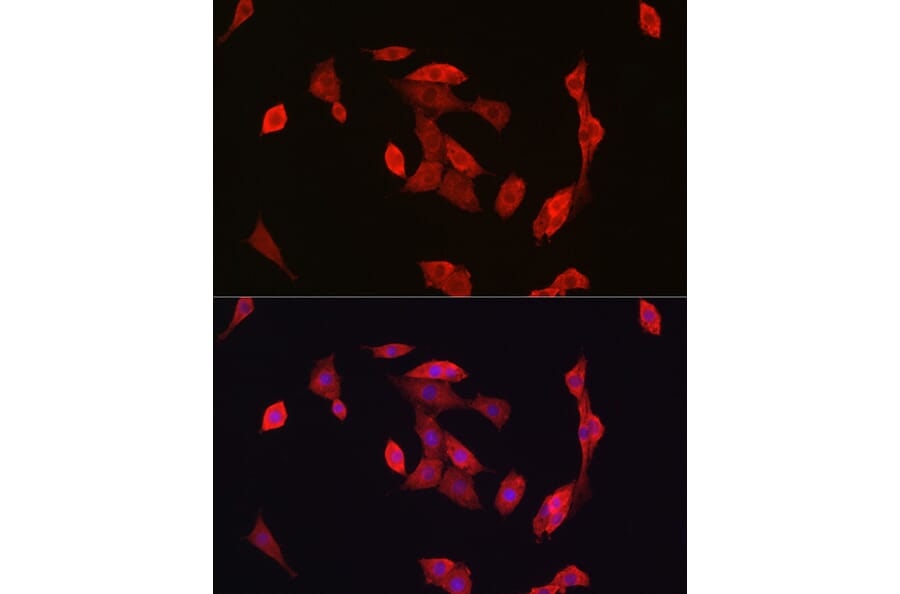 Immunofluorescence - Anti-Notch1 Antibody (A88025) - Antibodies.com