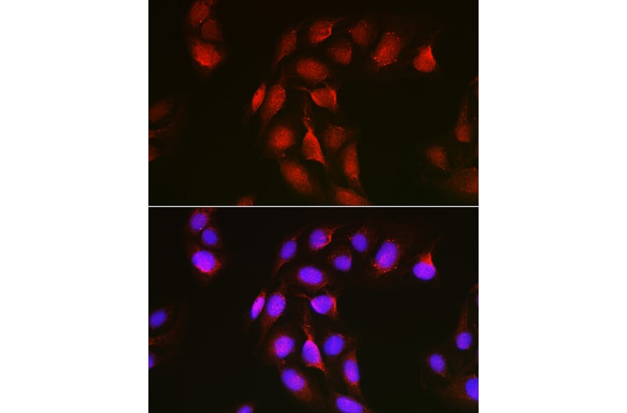 Immunofluorescence - Anti-Notch1 Antibody (A88026) - Antibodies.com