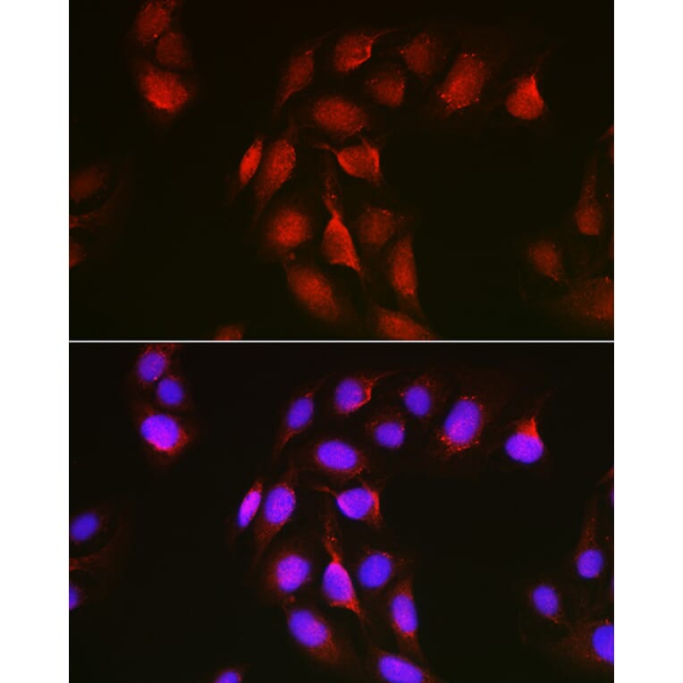 Immunofluorescence - Anti-Notch1 Antibody (A88026) - Antibodies.com