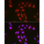 Immunofluorescence - Anti-Notch1 Antibody (A88026) - Antibodies.com