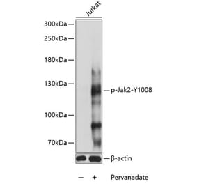 Western Blot - Anti-JAK2 (phospho Tyr1008) Antibody (A88027) - Antibodies.com