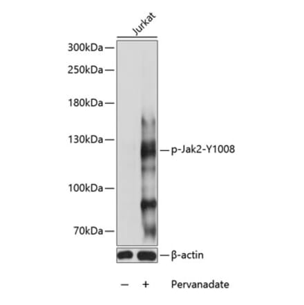 Western Blot - Anti-JAK2 (phospho Tyr1008) Antibody (A88027) - Antibodies.com