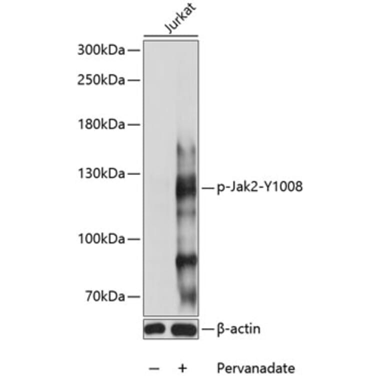 Western Blot - Anti-JAK2 (phospho Tyr1008) Antibody (A88027) - Antibodies.com