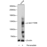 Western Blot - Anti-JAK2 (phospho Tyr1008) Antibody (A88027) - Antibodies.com