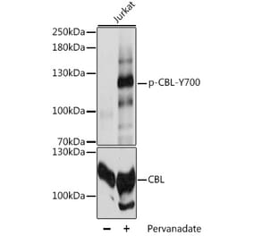 Western Blot - Anti-CBL (phospho Tyr700) Antibody (A88028) - Antibodies.com