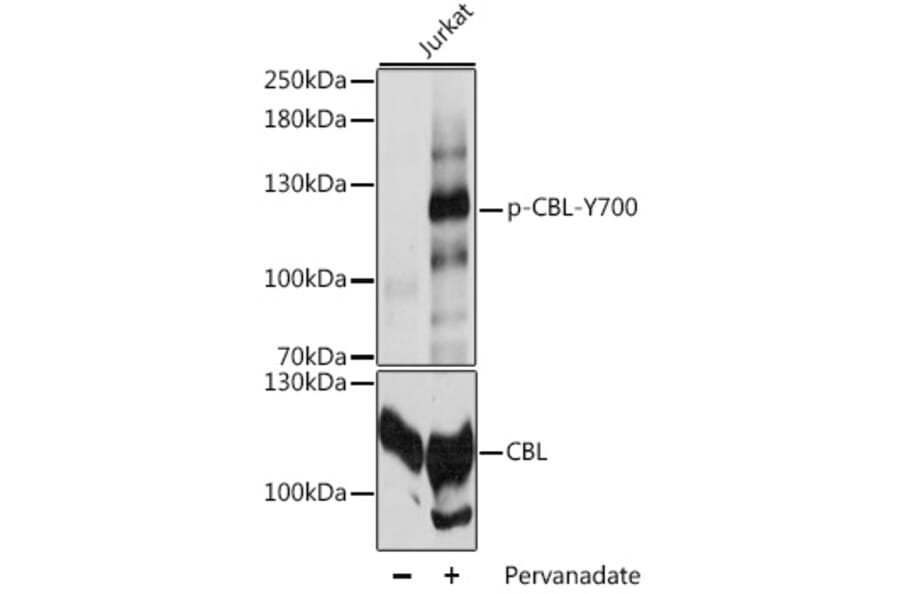 Western Blot - Anti-CBL (phospho Tyr700) Antibody (A88028) - Antibodies.com