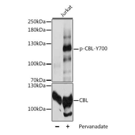 Western Blot - Anti-CBL (phospho Tyr700) Antibody (A88028) - Antibodies.com