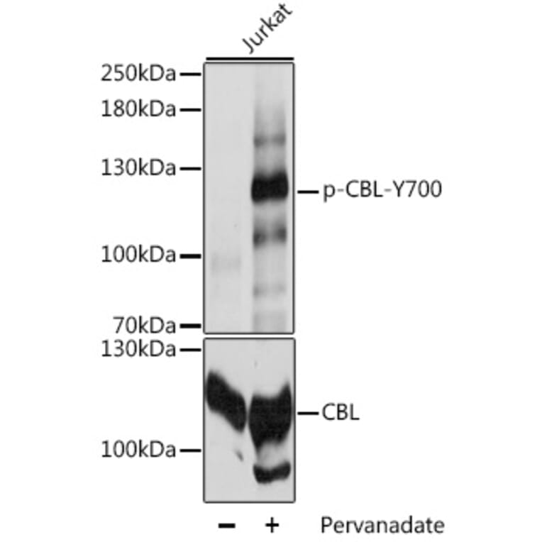 Western Blot - Anti-CBL (phospho Tyr700) Antibody (A88028) - Antibodies.com