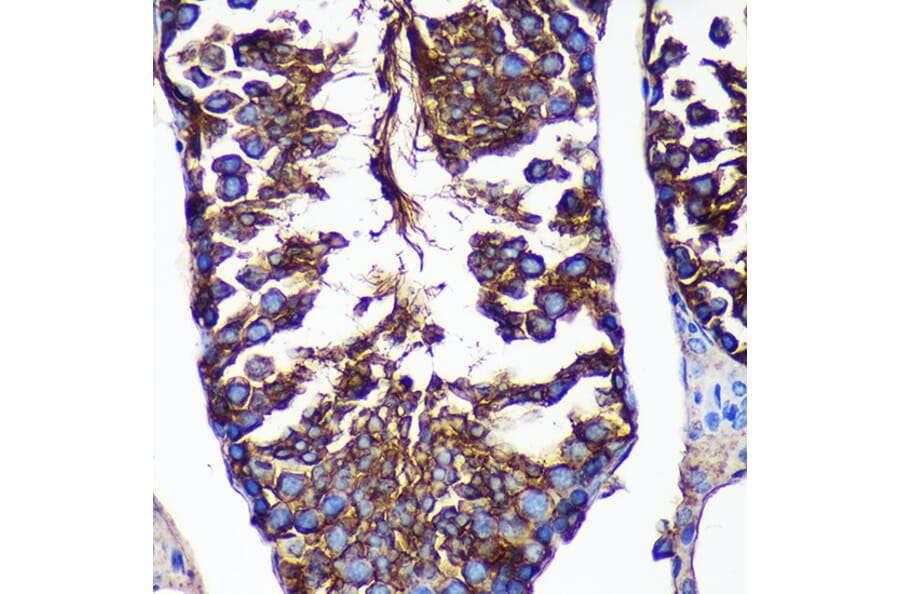 Immunohistochemistry - Anti-CTNNA3 Antibody (A88029) - Antibodies.com