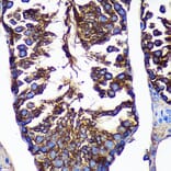 Immunohistochemistry - Anti-CTNNA3 Antibody (A88029) - Antibodies.com