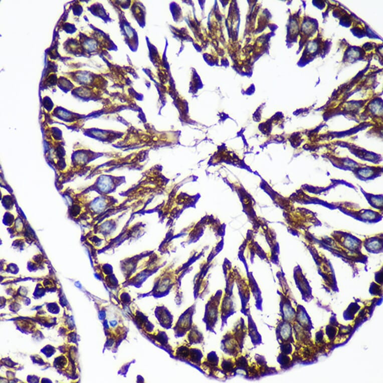 Immunohistochemistry - Anti-CTNNA3 Antibody (A88029) - Antibodies.com