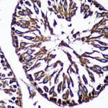 Immunohistochemistry - Anti-CTNNA3 Antibody (A88029) - Antibodies.com
