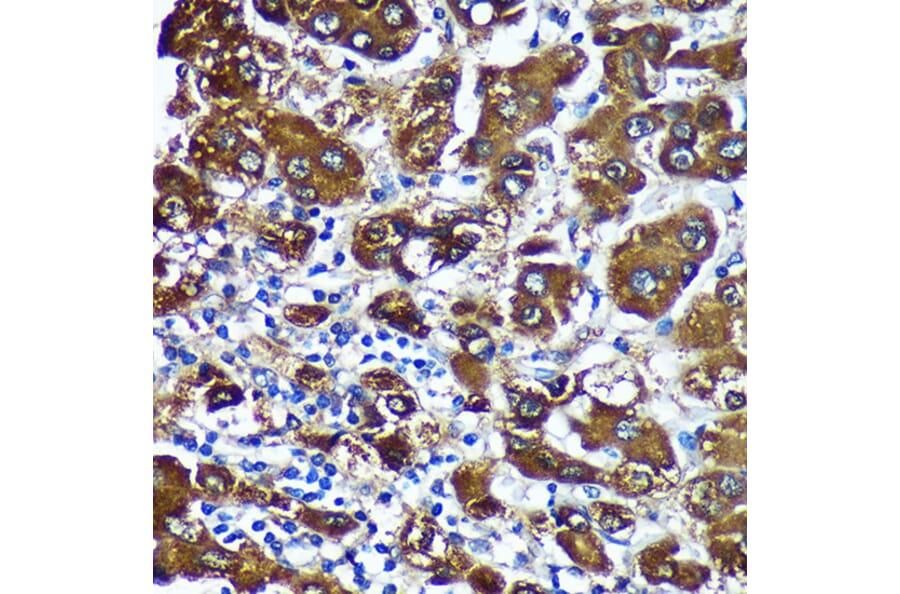 Immunohistochemistry - Anti-CTNNA3 Antibody (A88029) - Antibodies.com