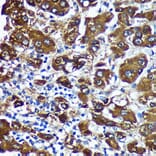 Immunohistochemistry - Anti-CTNNA3 Antibody (A88029) - Antibodies.com