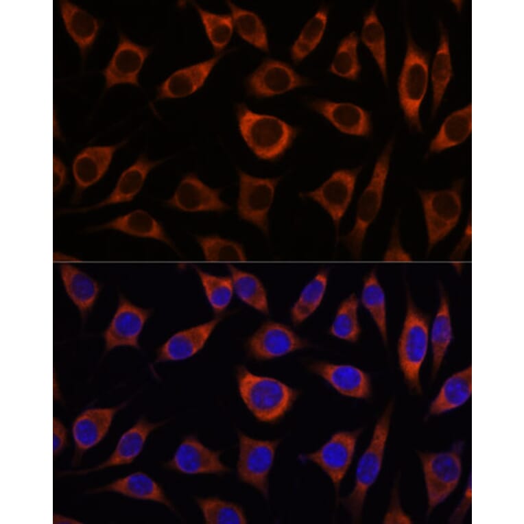 Immunofluorescence - Anti-CTNNA3 Antibody (A88029) - Antibodies.com