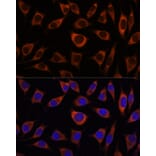 Immunofluorescence - Anti-CTNNA3 Antibody (A88029) - Antibodies.com