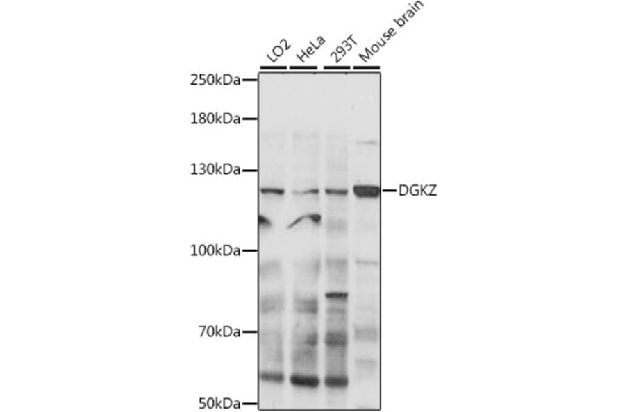 Western Blot - Anti-DGKZ/DGK-zeta Antibody (A88030) - Antibodies.com