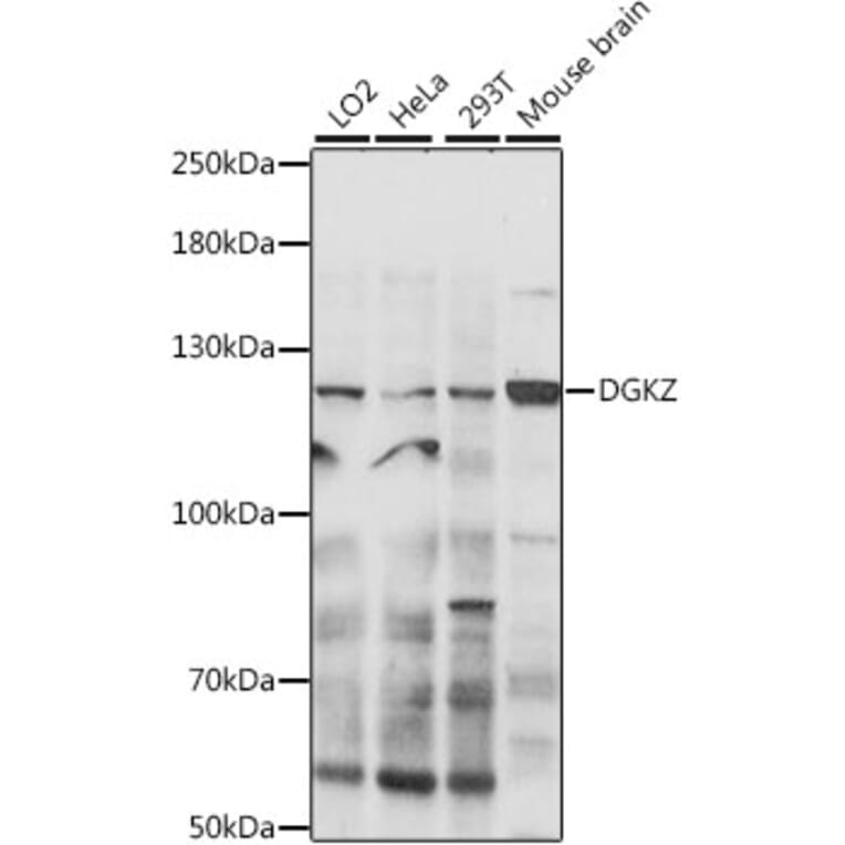 Western Blot - Anti-DGKZ/DGK-zeta Antibody (A88030) - Antibodies.com