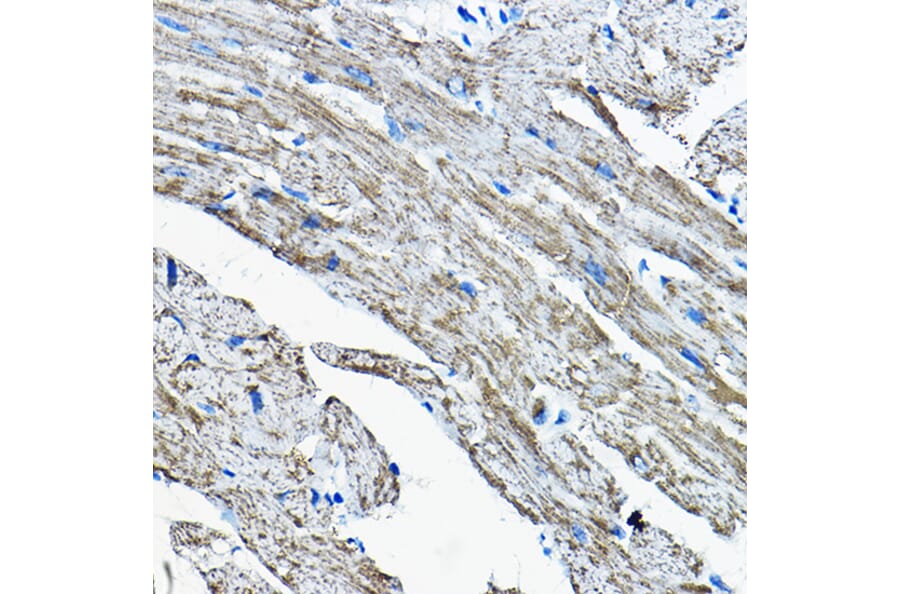 Immunohistochemistry - Anti-OGDHL Antibody (A88031) - Antibodies.com