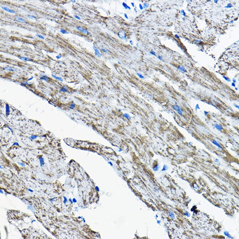 Immunohistochemistry - Anti-OGDHL Antibody (A88031) - Antibodies.com
