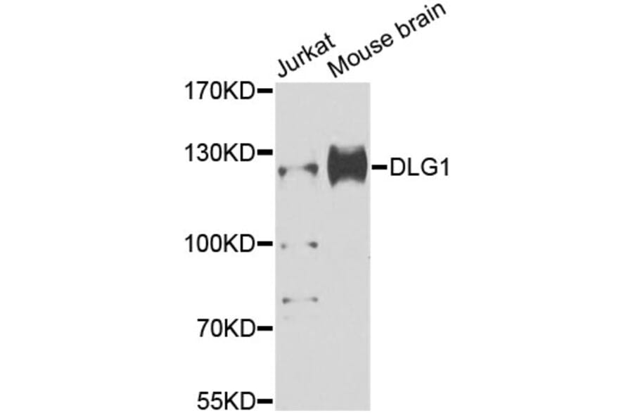 Western Blot - Anti-DLG1 Antibody (A12432) - Antibodies.com