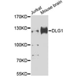 Western Blot - Anti-DLG1 Antibody (A12432) - Antibodies.com